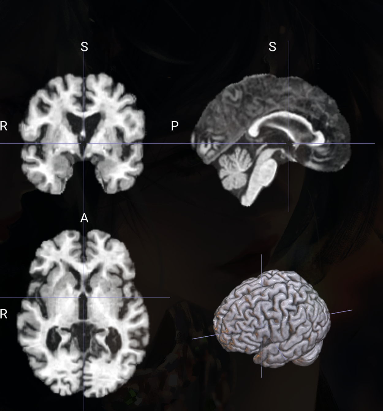 🧠 脑区任务MRI图像预处理