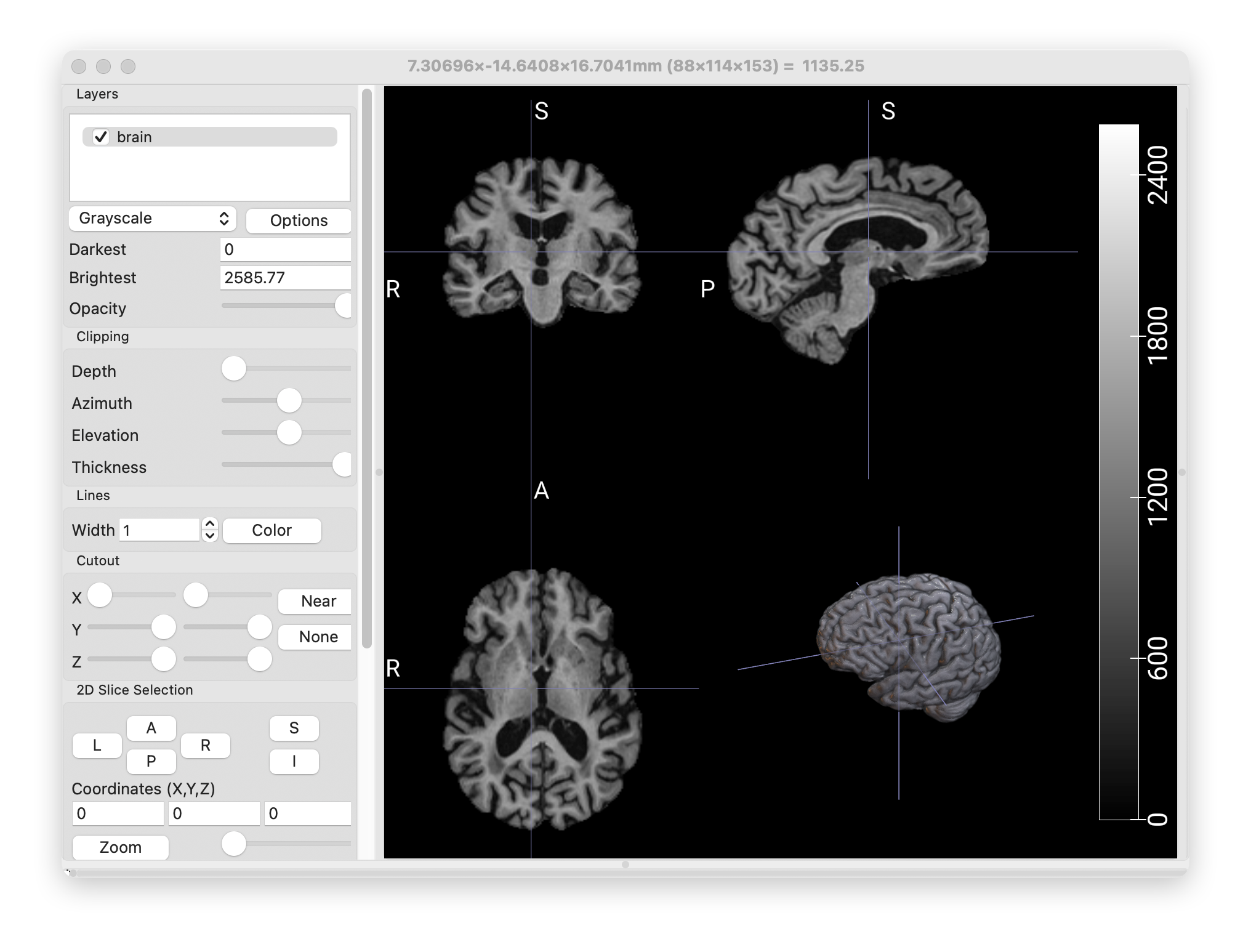 颅骨去除MRI图像
